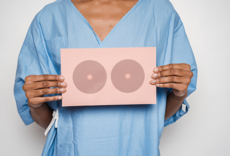 Câncer de mama: fatores de risco, prevenção e tratamento