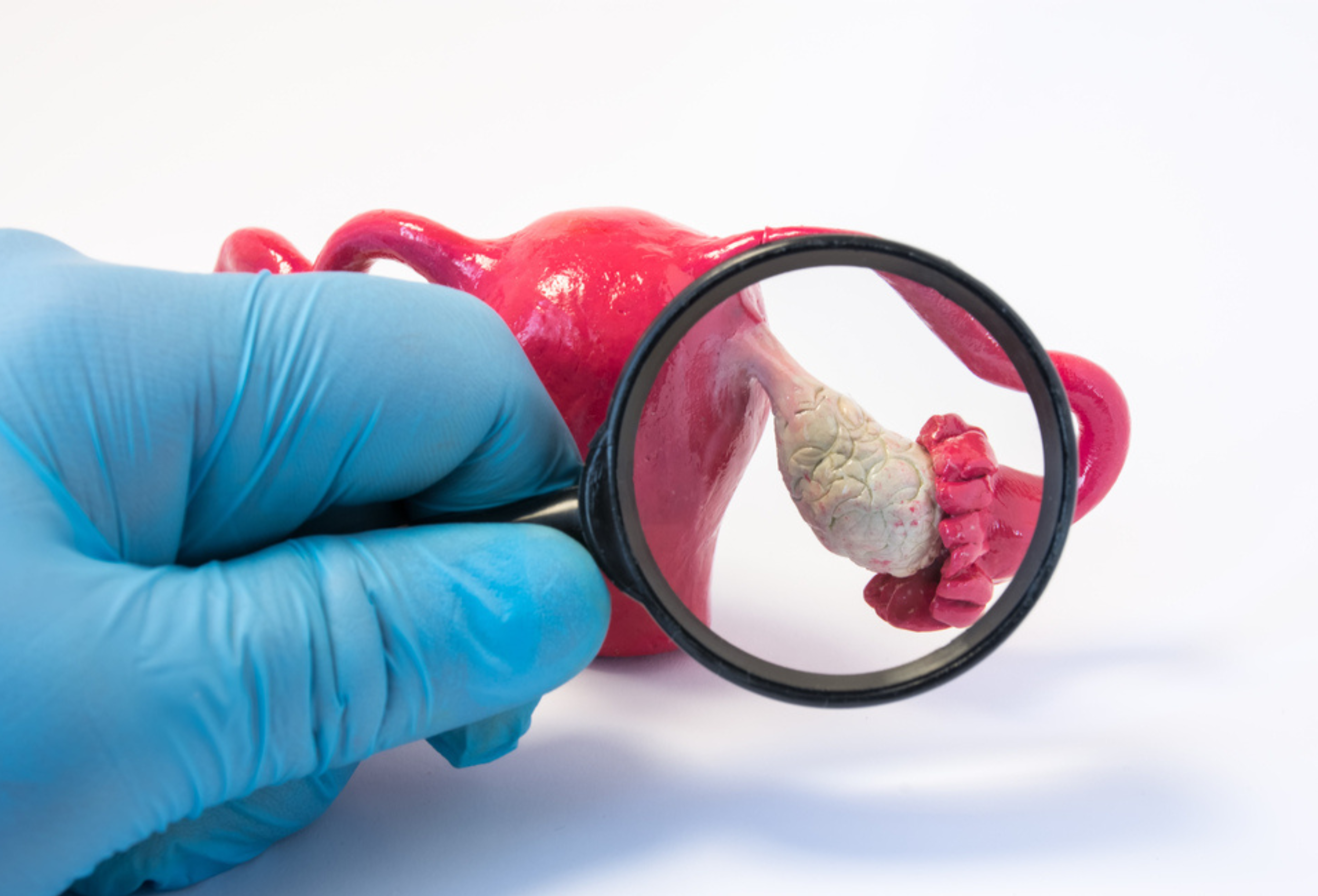 Hipogonadismo masculino: o que é e como tratar