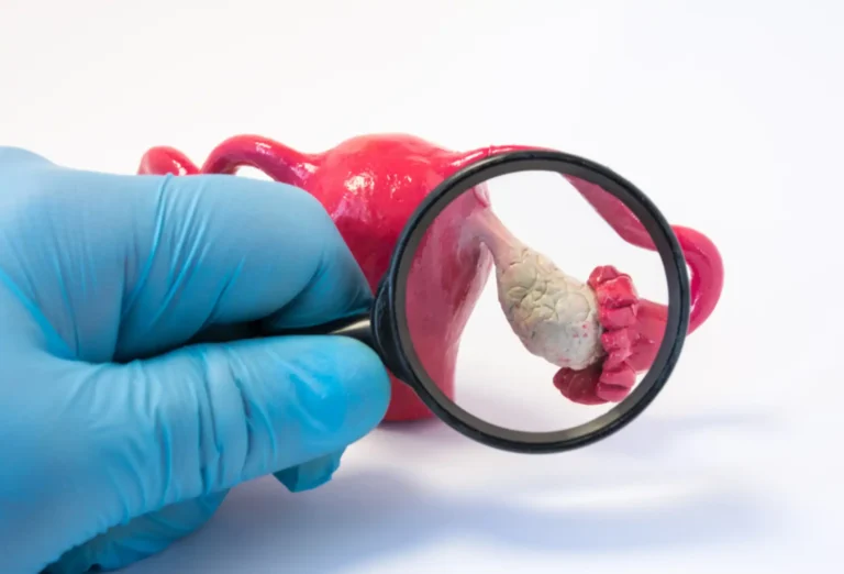 Hipogonadismo masculino: o que é e como tratar